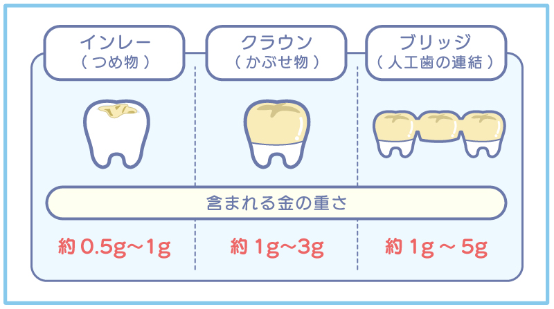 3種類の金歯に含まれるゴールド含有量比較図解