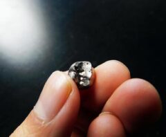 銀歯が抜けて買取に出したい人