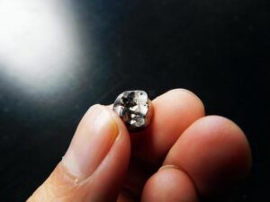 銀歯が抜けて買取に出したい人