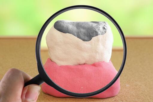 入れ歯・歯科用のパラジウムは買取できる?