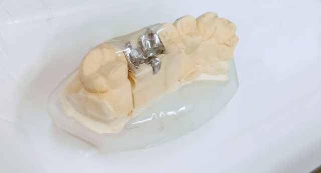 金パラ(金銀パラジウム)で買取対象となるもの|こんなものも売れる?